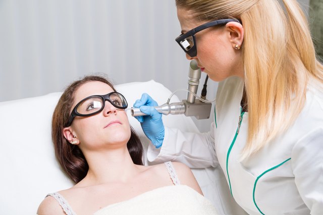 medical laser, face, liver spot