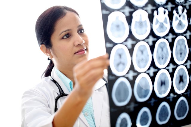 Female doctor examining a brain computerized scan