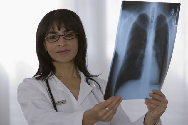 Female doctor holding x-ray