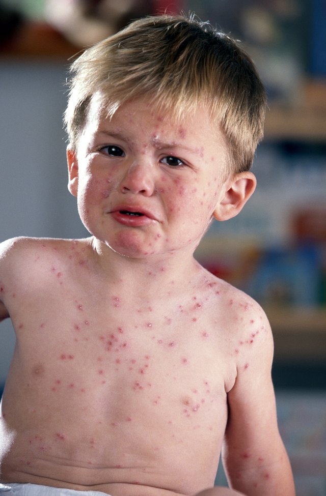 what-causes-fever-in-babies-dr-alami-s-kids-all-about-kids