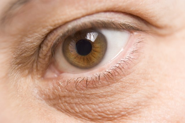 Woman's eye