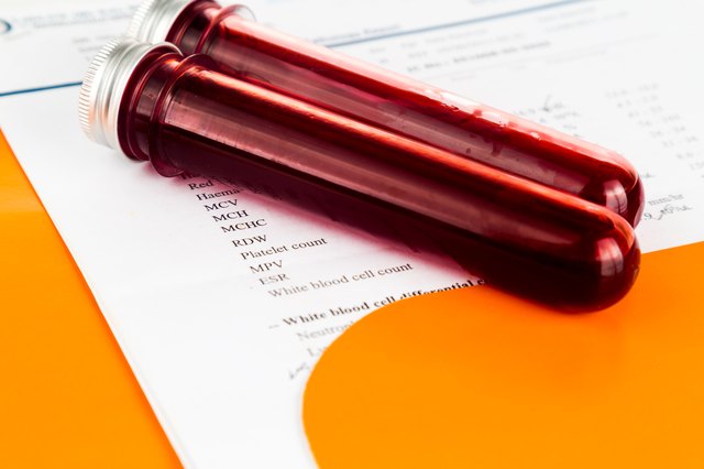 Blood sample in test tubes with health analysis screening report