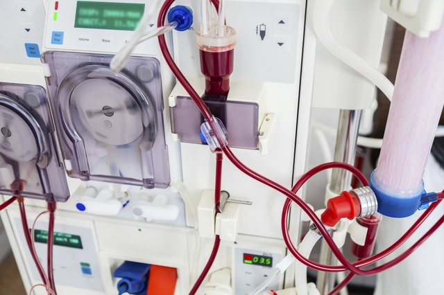 How Is Osmosis Used in Kidney Dialysis? | Livestrong.com