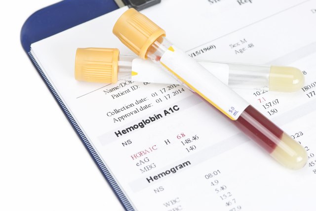 what-are-the-normal-a1c-levels-for-children-livestrong