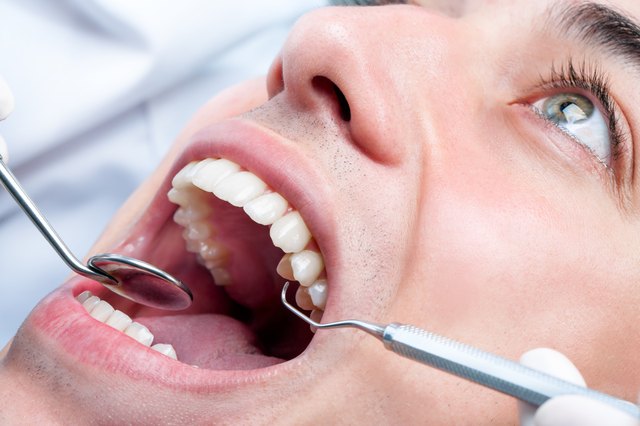 Young man whitening teeth at dentist.