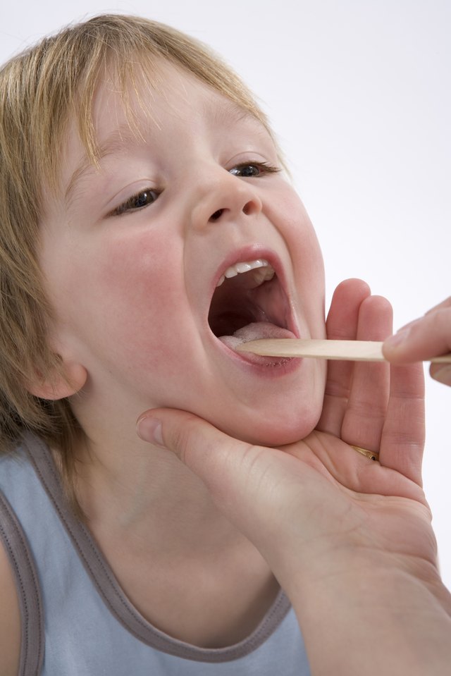 Doctor is looking into the mouth of a little boy