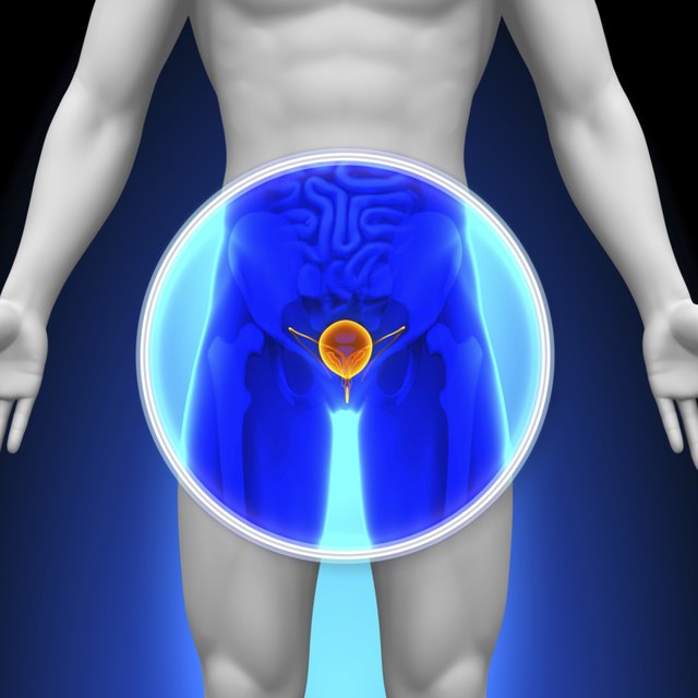 Medical X-Ray Scan - Bladder