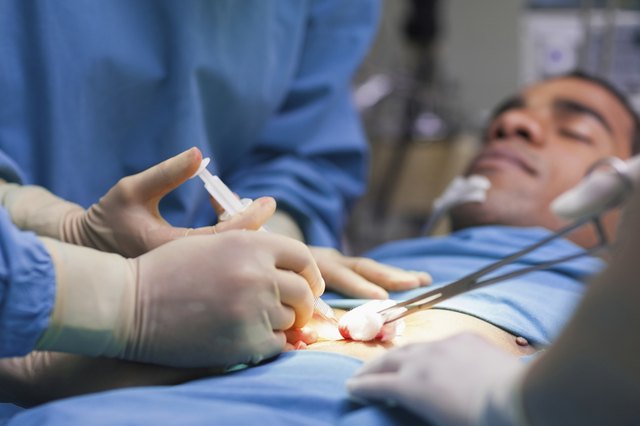 Close up of an operation