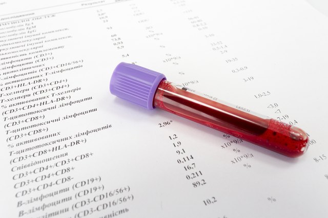 Test tubes with blood on blank with normal results