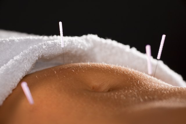 Acupuncture belly