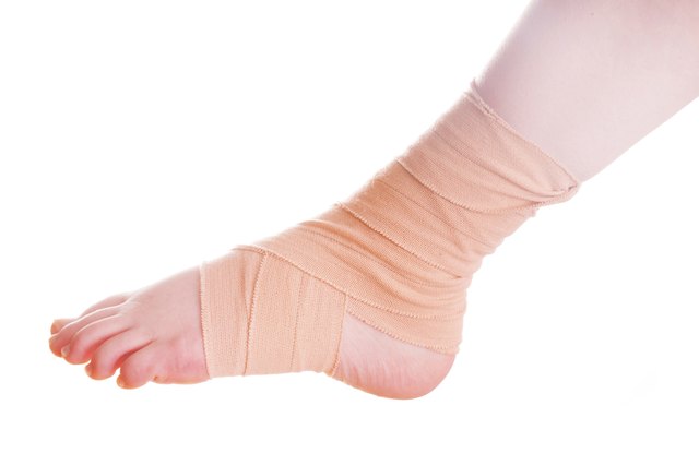 Swollen foot