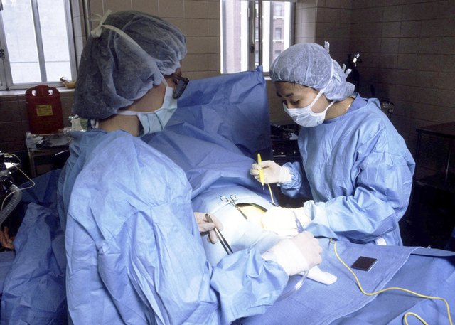 Surgeons performing a cesarean