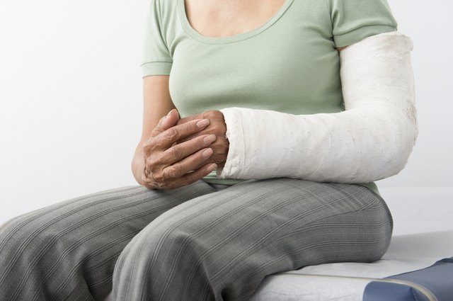 Senior woman sits with plastercast on broken arm, mid-section