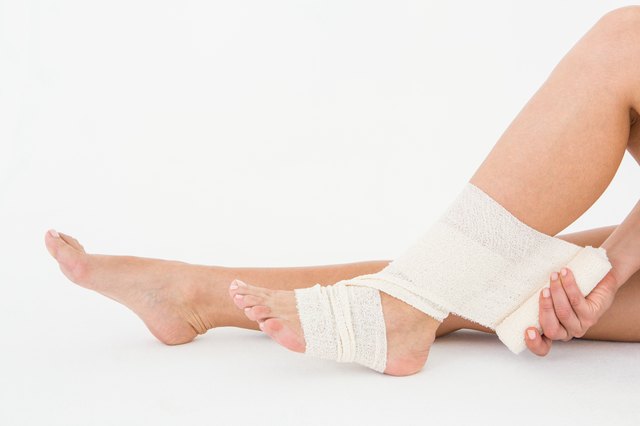 How Long Does it Take to Rehabilitate a Snapped Achilles Tendon ...