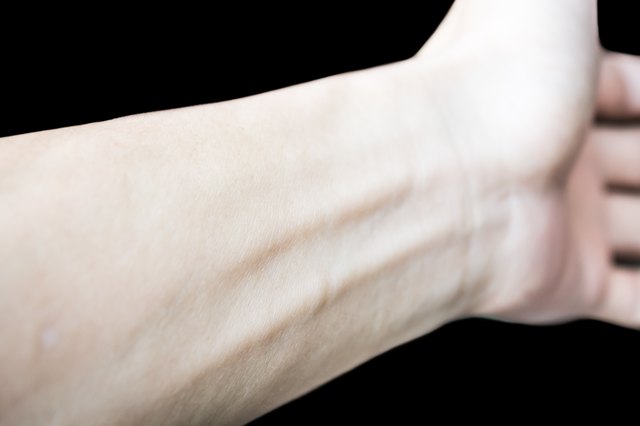 Left arm isolated on black