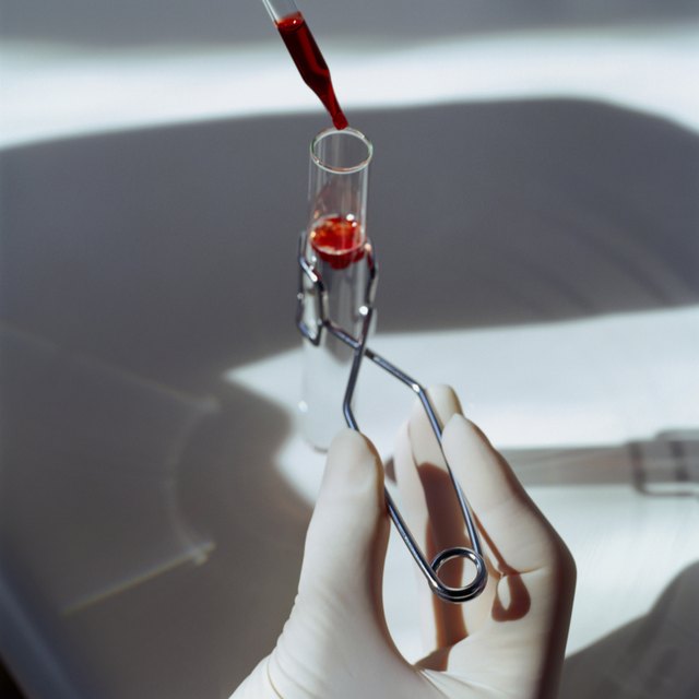 Hand with Test Tube and Dropper