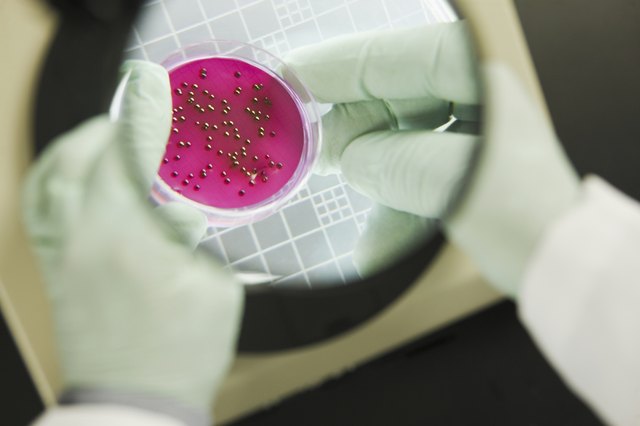 Scientist analyzing bacterial colonies