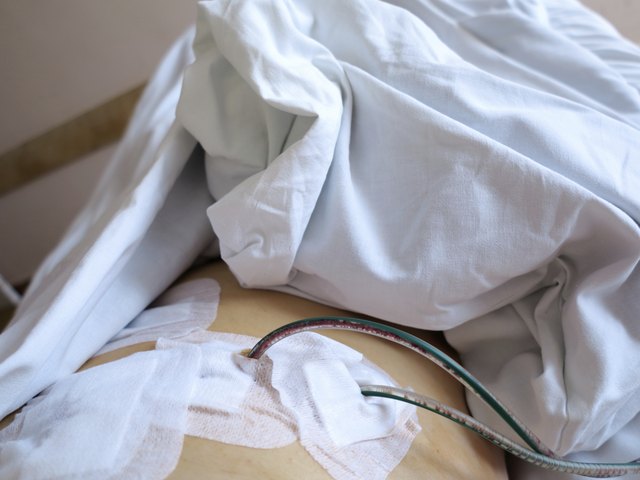 patient in hospital after surgery with drainage