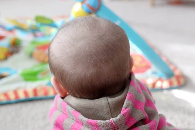 how-to-prevent-a-bald-spot-from-developing-on-the-back-of-a-baby-s-head