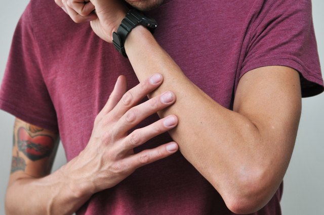 How to Get Rid of Acne on Your Arms | Livestrong.com