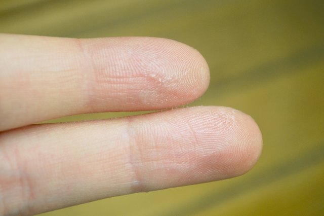 how-to-get-nail-glue-off-of-your-skin-livestrong